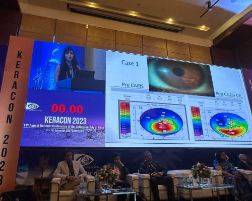 keratoconus label_speaking about cairs_